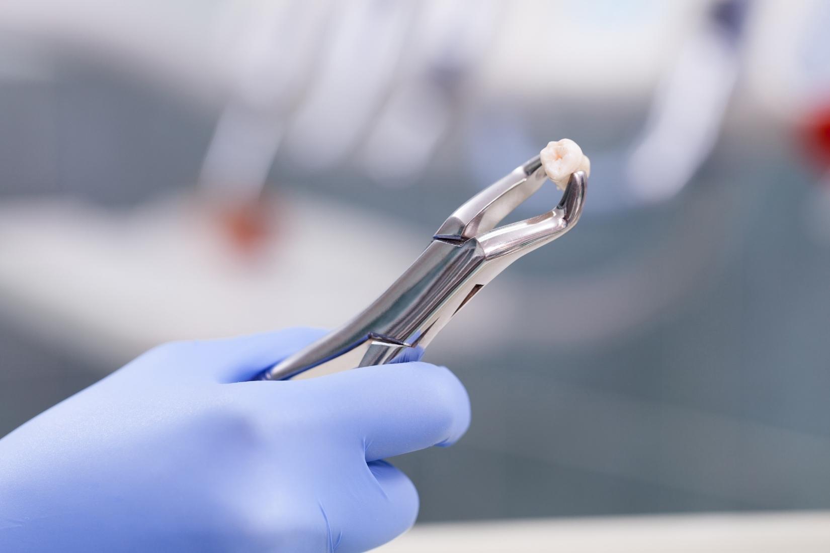 Diş çekimi sonrası ağız bakımında dikkat edilmesi gereken adımları gösteren bilgilendirici görsel.