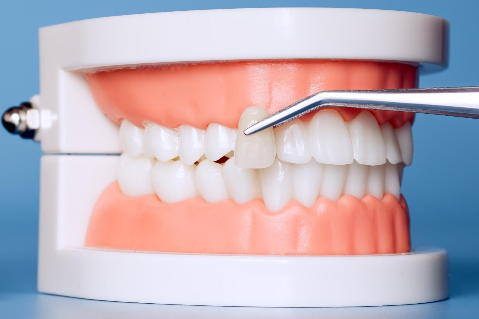 Diş formu ile yüz oranları arasındaki estetik ilişkiyi gösteren diş sağlığı görseli.