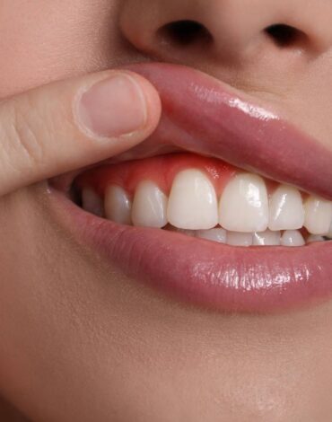 Diş eti şişliğine yol açan faktörleri ve günlük ağız bakım alışkanlıklarının önemini gösteren bilgilendirici görsel.