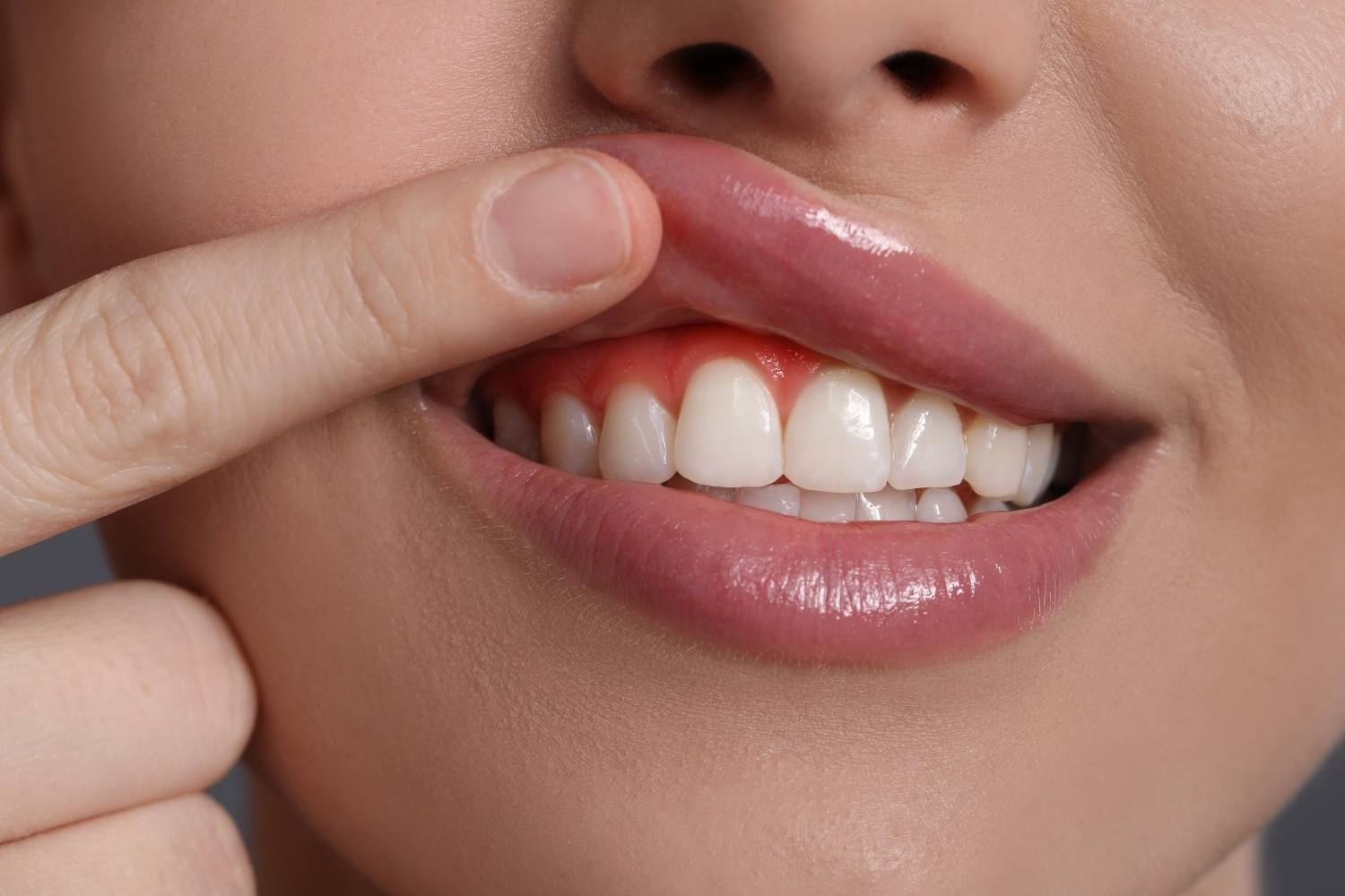 Diş eti şişliğine yol açan faktörleri ve günlük ağız bakım alışkanlıklarının önemini gösteren bilgilendirici görsel.