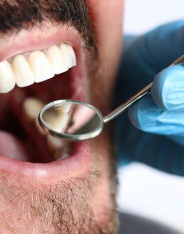 İlaç kullanımına bağlı ağız kuruluğunun nedenlerini ve ağız içi dokular üzerindeki etkilerini gösteren bilgilendirici görsel.