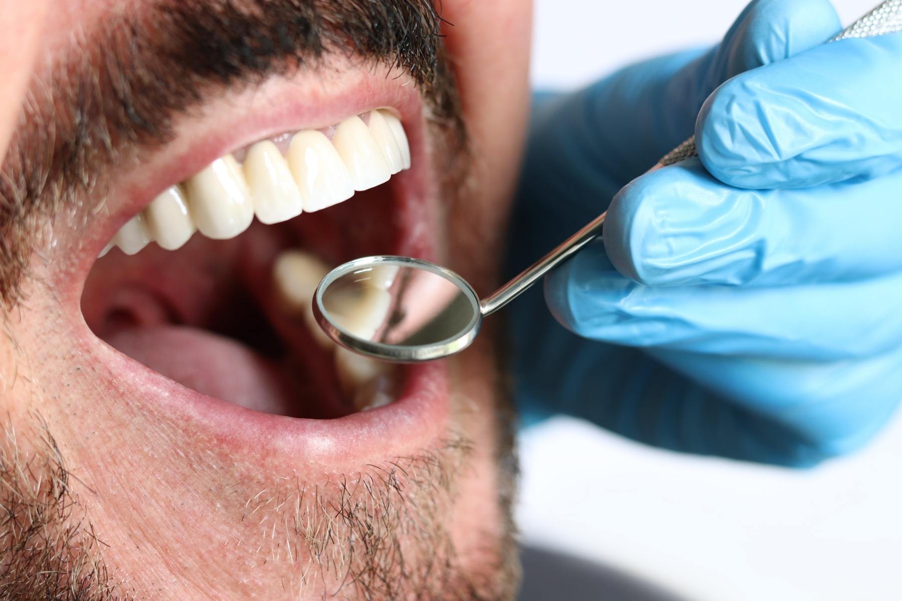 İlaç kullanımına bağlı ağız kuruluğunun nedenlerini ve ağız içi dokular üzerindeki etkilerini gösteren bilgilendirici görsel.