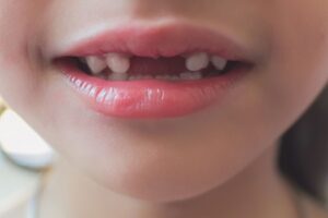 Süt dişlerinin ağız sağlığı, çene gelişimi ve kalıcı dişler üzerindeki önemini anlatan bilgilendirici görsel.