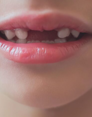 Süt dişlerinin ağız sağlığı, çene gelişimi ve kalıcı dişler üzerindeki önemini anlatan bilgilendirici görsel.