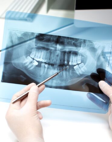 Diş hekimliğinde kullanılan radyolojik görüntüleme yöntemlerinin ağız ve çene yapısını nasıl gösterdiğini anlatan görsel.