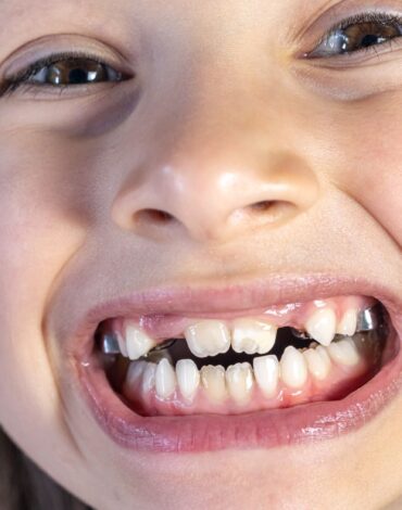 Süt dişlerinin çene gelişimi ve kalıcı dişler için neden önemli olduğunu gösteren bilgilendirici görsel.