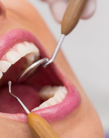 Diş tedavisi sonrası ağız bakımını ve doğru diş fırçalama alışkanlığını gösteren bilgilendirici dental görsel.