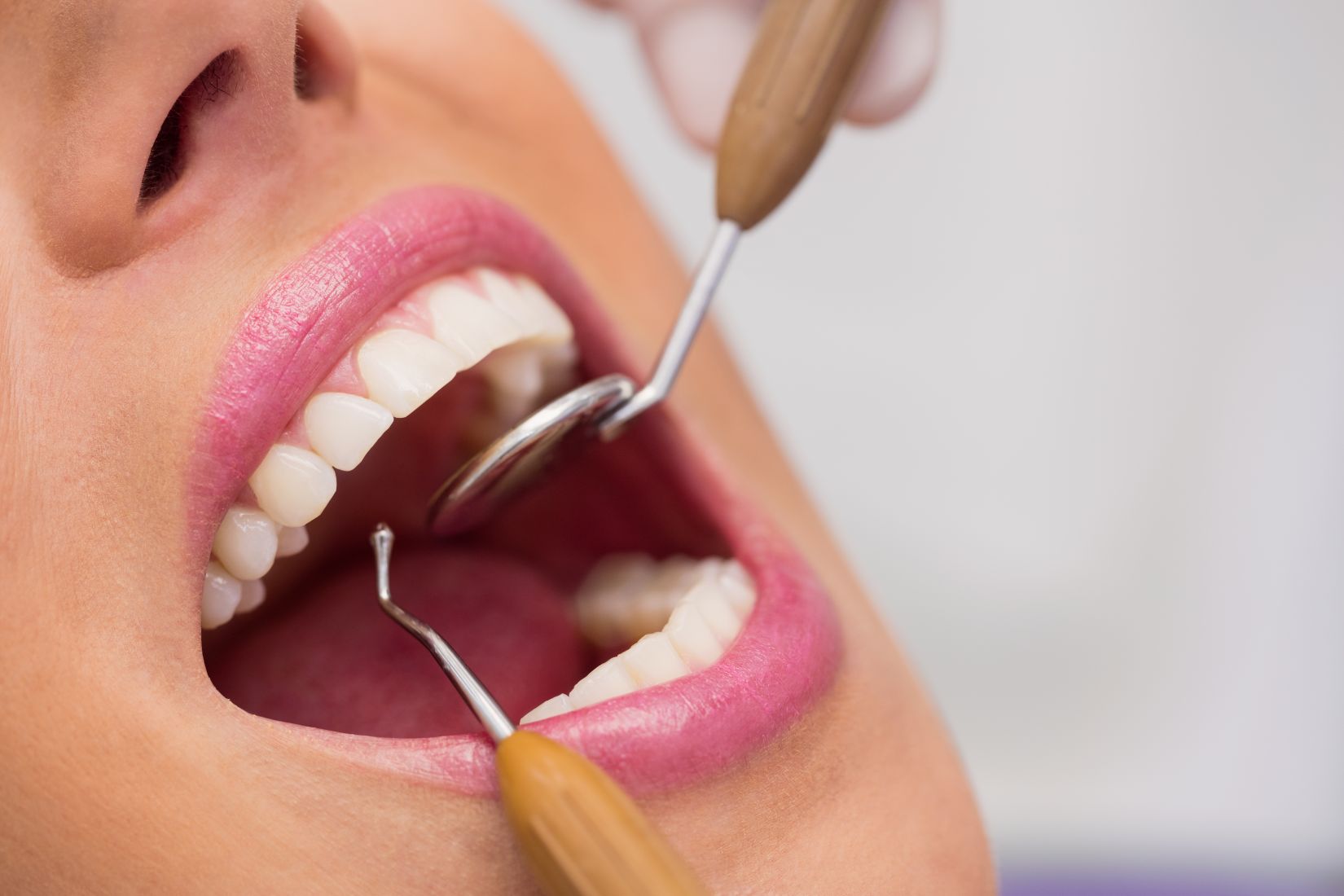 Diş tedavisi sonrası ağız bakımını ve doğru diş fırçalama alışkanlığını gösteren bilgilendirici dental görsel.