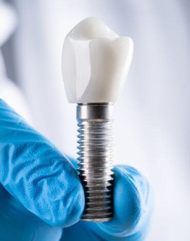 Çene kemiğine yerleştirilen dental implant ve üzerine yapılan protez ile çiğneme fonksiyonunu gösteren dental görsel.