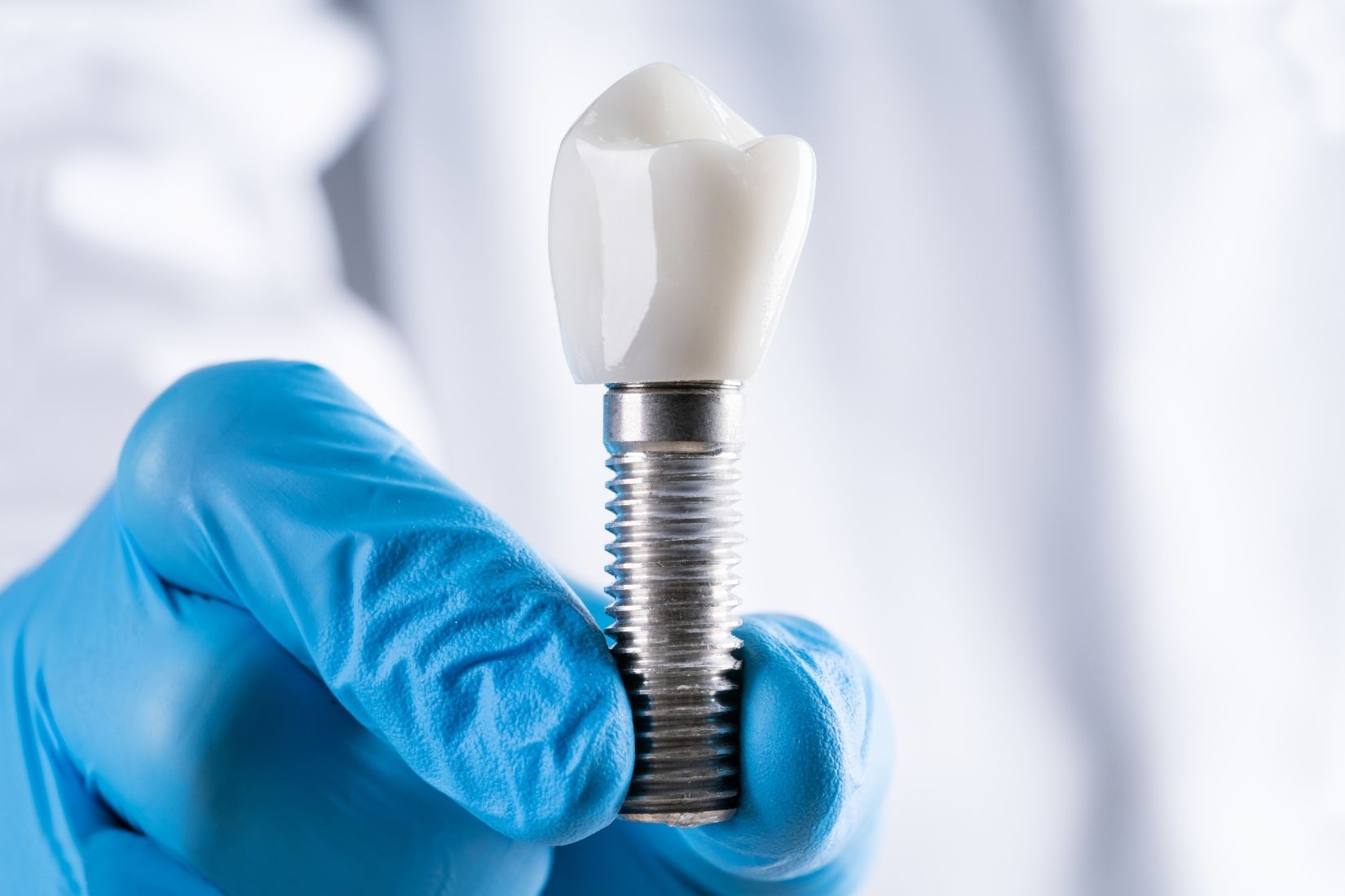 Çene kemiğine yerleştirilen dental implant ve üzerine yapılan protez ile çiğneme fonksiyonunu gösteren dental görsel.