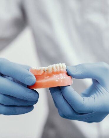 İmplant tedavisinin aşamalarını, cerrahi yerleştirme ve protez sürecini gösteren dental uygulama görseli.