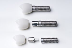 Tam dişsizlikte full mouth implant planlamasını ve implant destekli sabit protez değerlendirmesini gösteren görsel.