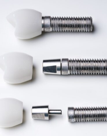 Tam dişsizlikte full mouth implant planlamasını ve implant destekli sabit protez değerlendirmesini gösteren görsel.