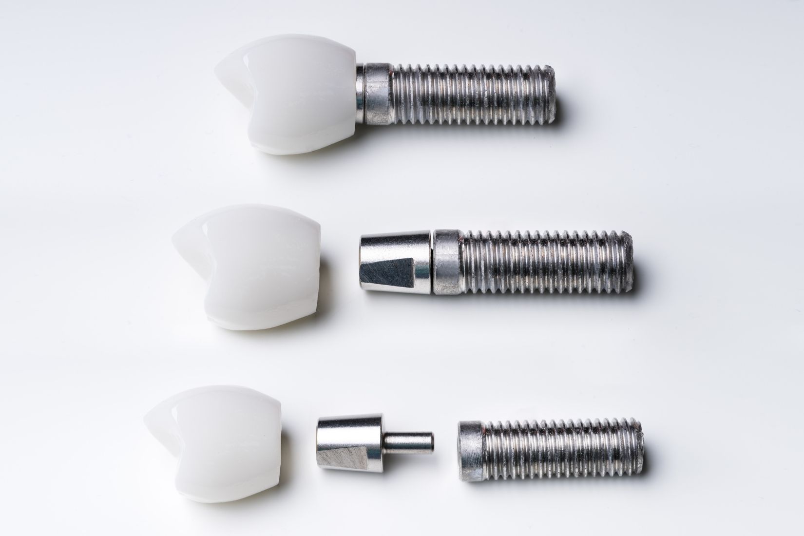 Tam dişsizlikte full mouth implant planlamasını ve implant destekli sabit protez değerlendirmesini gösteren görsel.