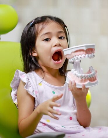 Azı dişlerinin çiğneme yüzeylerine uygulanan fissür örtücü işlemini gösteren dental görsel.