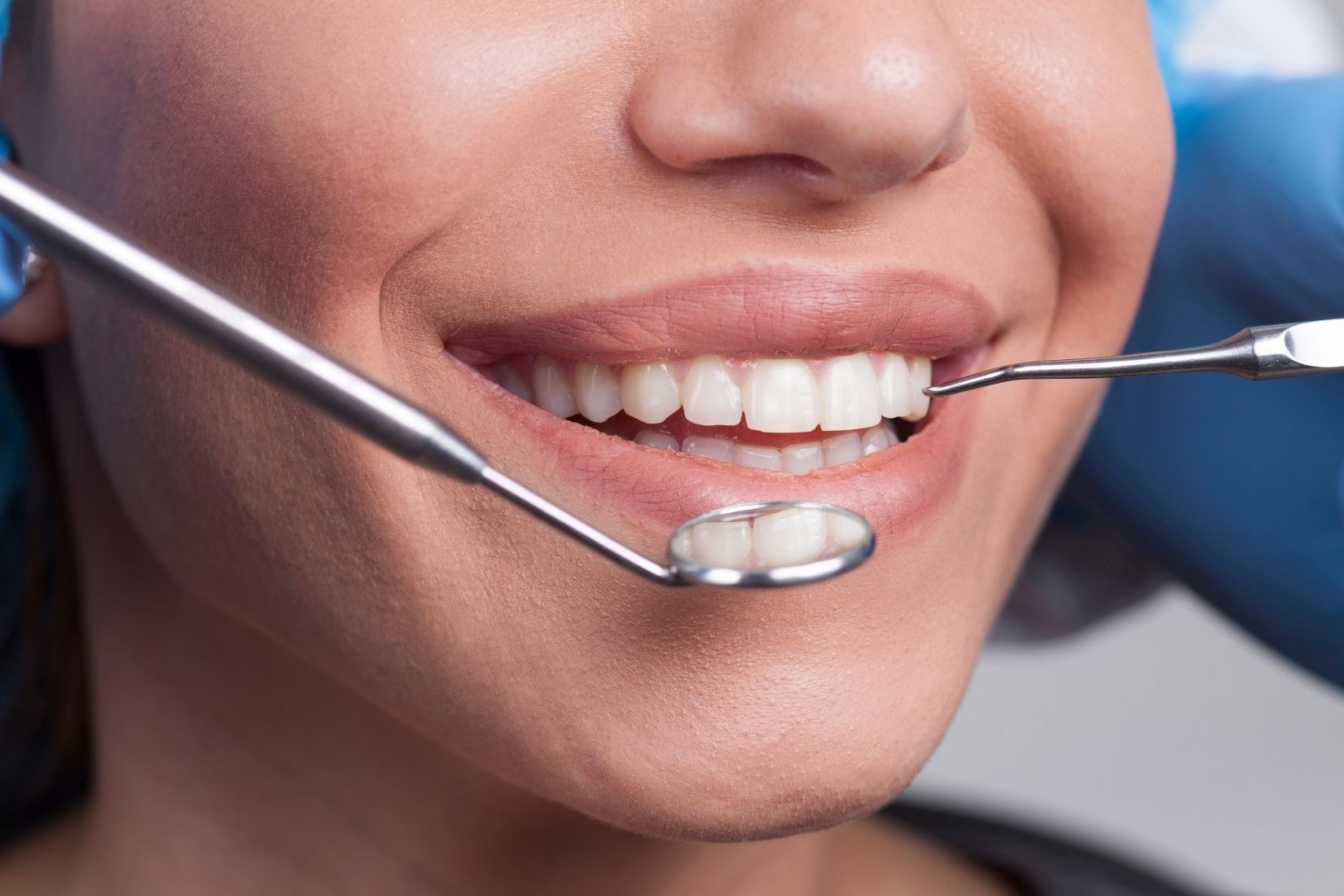 Çene kemiği değerlendirmesi, kemik kaybı analizi ve implant planlamasını gösteren dental görüntü.