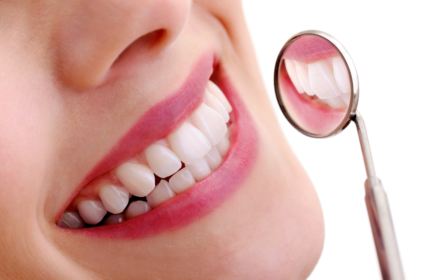 Ön dişlerde kompozit bonding uygulamasının planlama ve şekillendirme sürecini gösteren dental görsel.