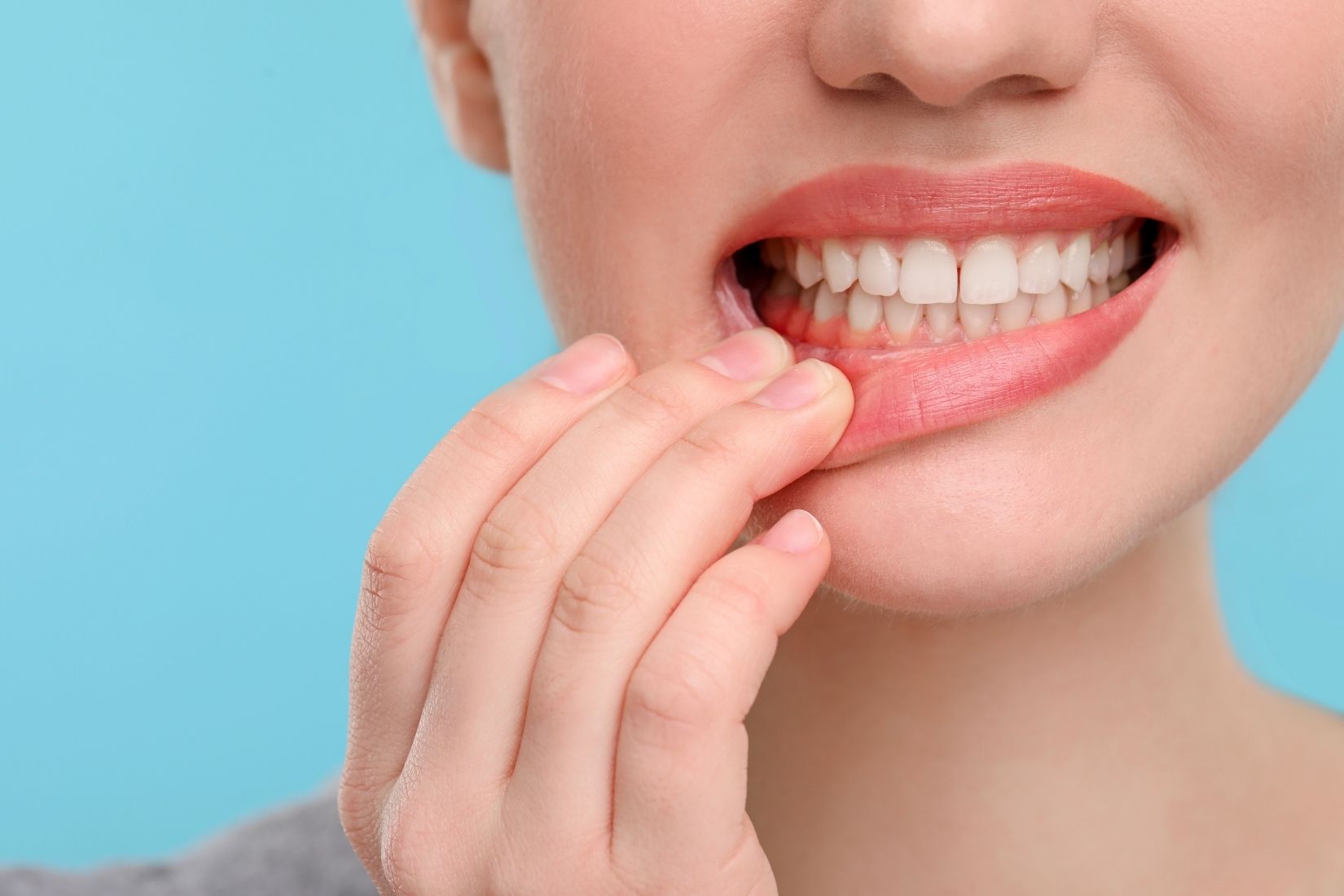 Diş taşı temizliği öncesi ve sonrası ağız hijyeni değerlendirmesini gösteren dental muayene görseli.