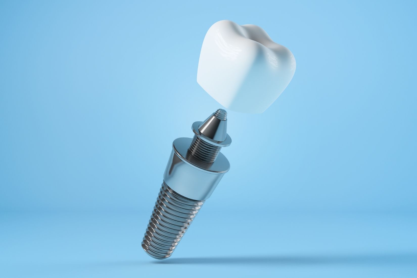 implant-cevresinde-kanama-neden-gorulebilir
