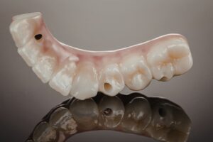 Toronto protez planlamasında implant destekli sabit protezin dijital değerlendirme sürecini gösteren görsel.