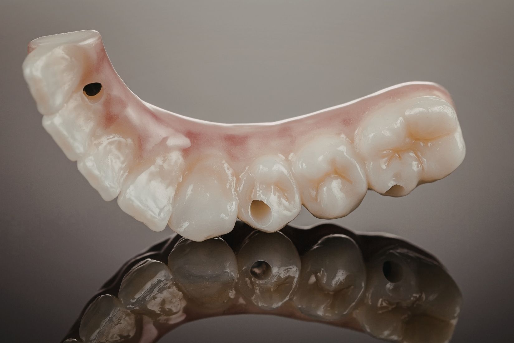 Toronto protez planlamasında implant destekli sabit protezin dijital değerlendirme sürecini gösteren görsel.