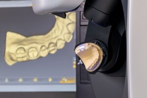 Dijital ağız içi tarama ve bilgisayar destekli restorasyon tasarımını gösteren CAD/CAM diş hekimliği uygulaması.