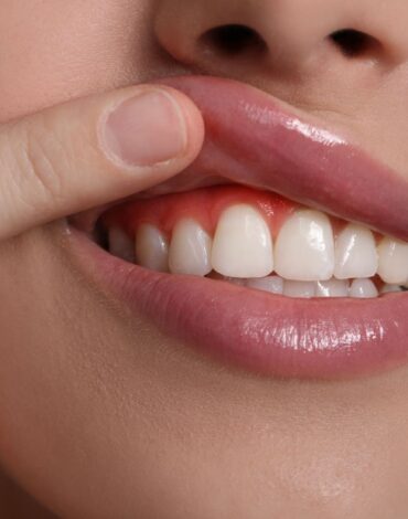 konya-periodontoloji-hangi-agiz-ve-dis-sorunlariyla-ilgilenir